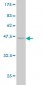 SSR4 Antibody (monoclonal) (M01)
